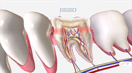 Pathologie Anatomique 3D