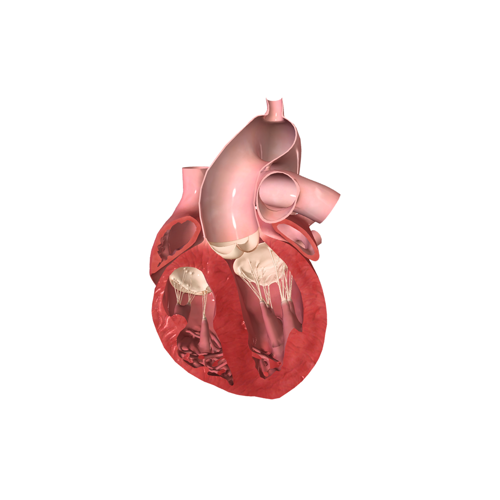 Congenital Heart Defects